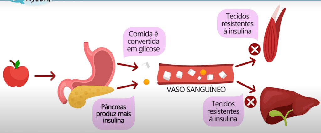 A glicose é alguém necessitando entrar em uma casa, as células do corpo como a casa e a insulina como a chave para abrir a porta.