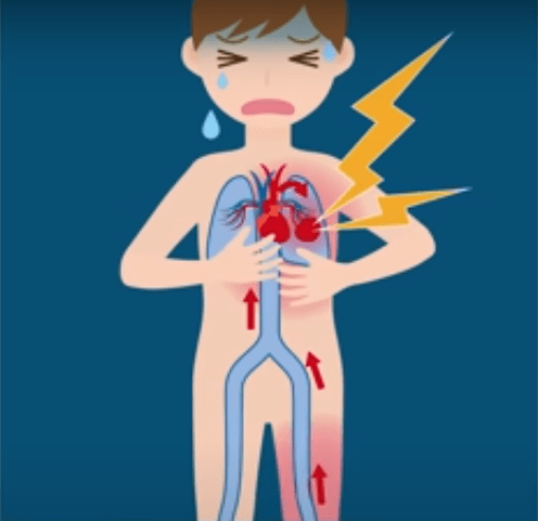 Falta de ar pode indicar embolia pulmonar