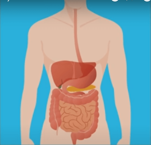 Câncer de cólon, ou câncer de intestino grosso, é um dos tumores mais frequentes