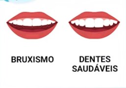 Observe que as bordas dos dentes parecem planas e o dente aparenta ser menor.