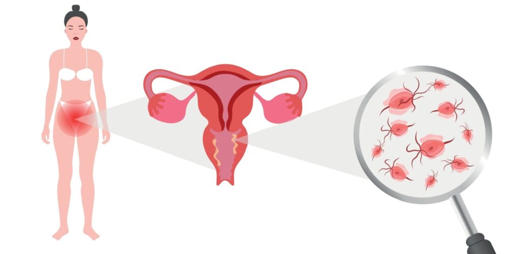 Shutterstock 2587504287