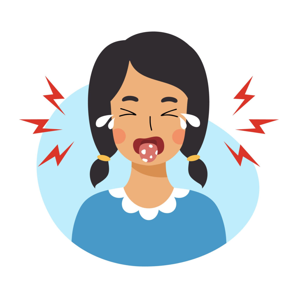 Girl,With,Stomatitis,On,Her,Tongue.,Baby,Is,Crying,Because