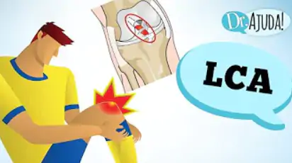 Ligamento cruzado anterior