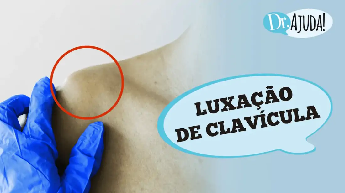 Luxacao de clavisula