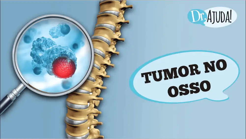 Tumor osseo