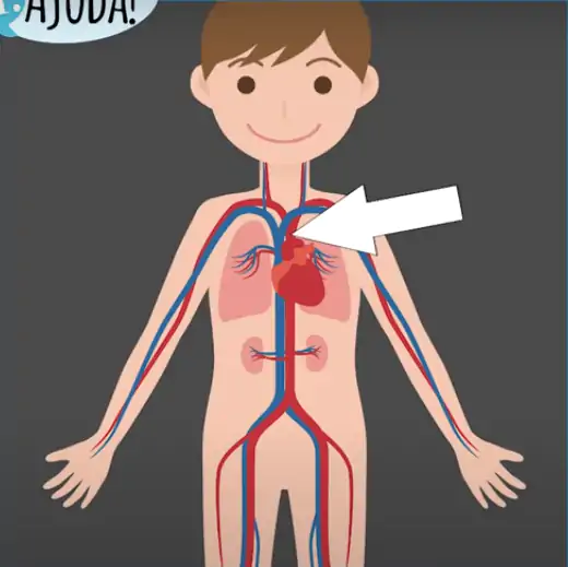 O rompimento do aneurisma de aorta é uma situação de emergência