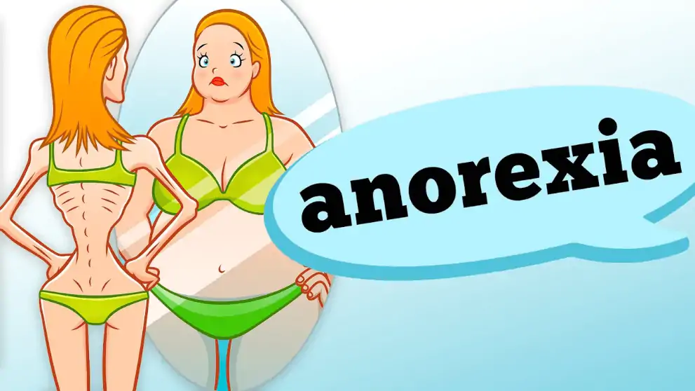 anorexia