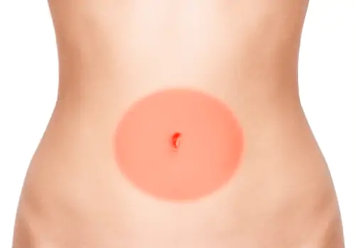 A dor tem início ao redor do umbigo