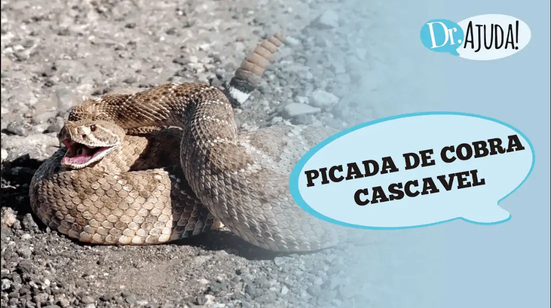 picada de cobra