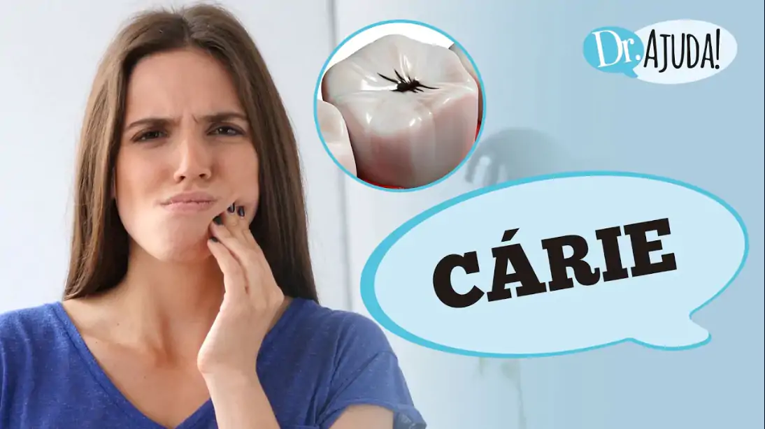 carie capa