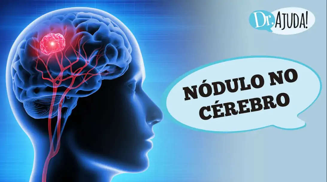 nodulo no cerebro