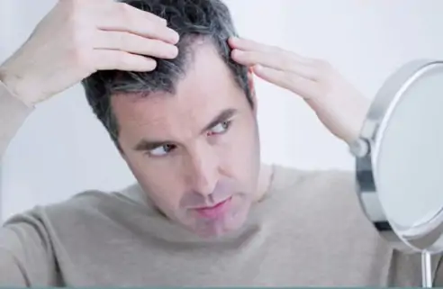 É normal perder até 100 fios. Mais do que isso é anormal.