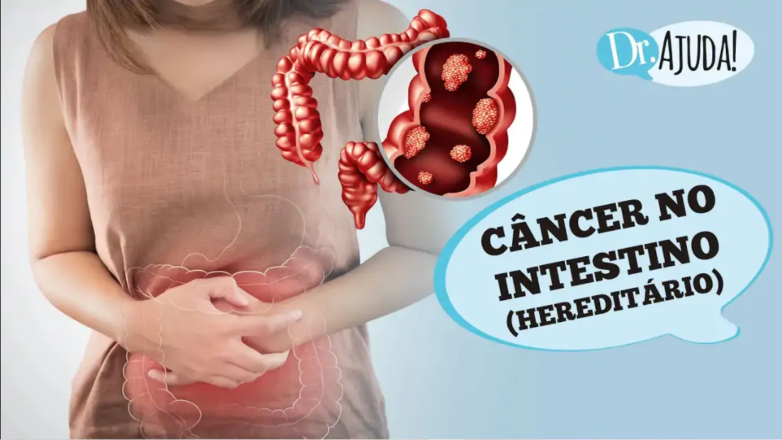 cancer de intestino hereditario