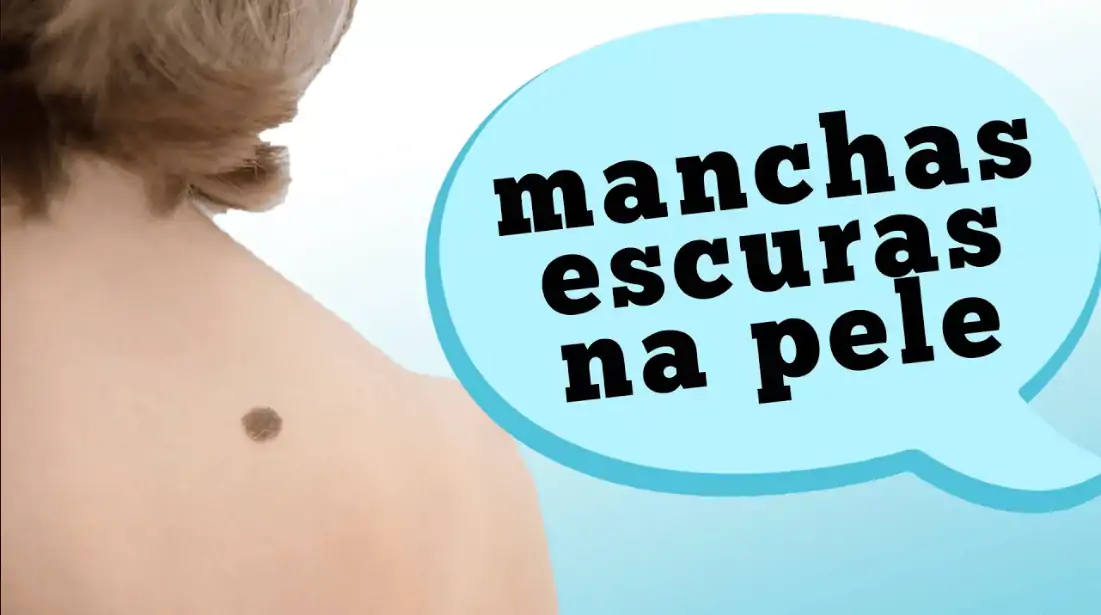 manchas escuras