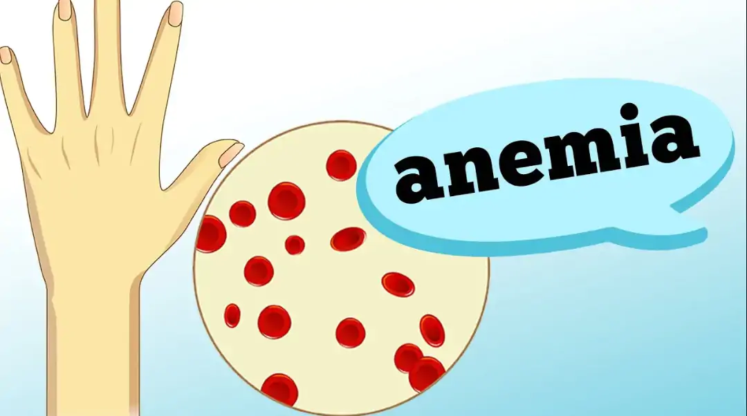 anemia