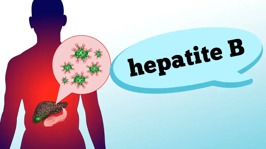 hepatite b