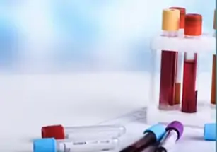 Um hemograma é realizado para diagnosticar anemia