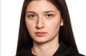 A adolescência é caracterizada por acne e pele oleosa.