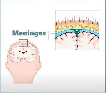 A meningite é uma inflamação.