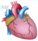 O infarto do miocárdio é o mais conhecido.