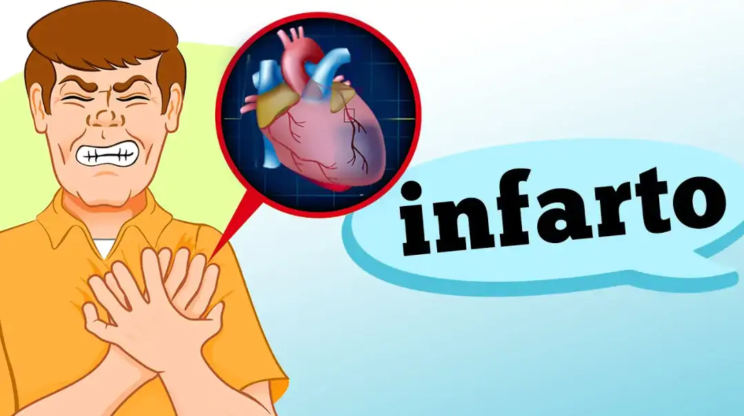 infarto