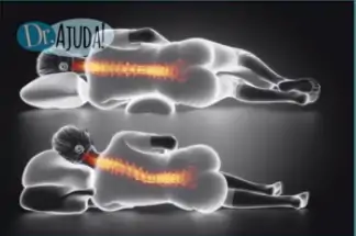 O torcicolo muscular é a principal causa.