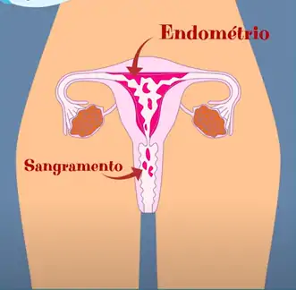 A menstruação é a descamação das paredes internas do útero.