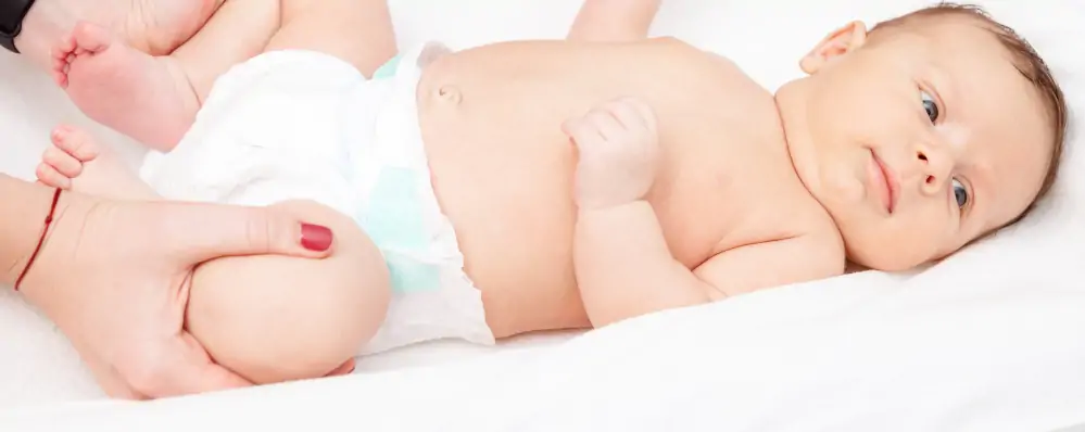 displasia de quadril