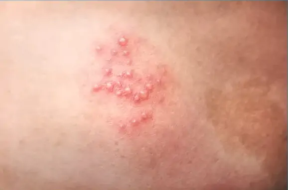 Captura de Tela 2025 04 16 às 06.22.21