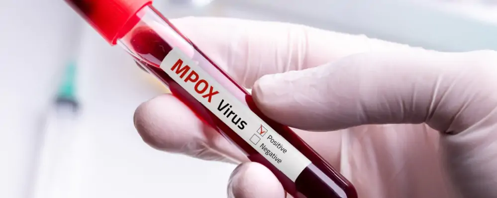 Shutterstock 2503799829