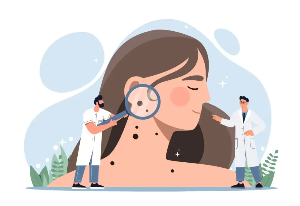 Skin,Cancer,Concept.,Doctors,With,Magnifying,Glasses,In,Their,Hands